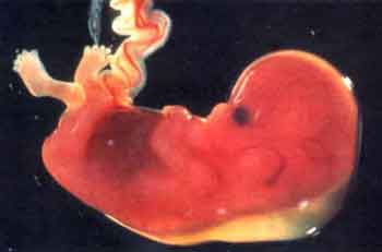 Embryo mit Nabelschnur
